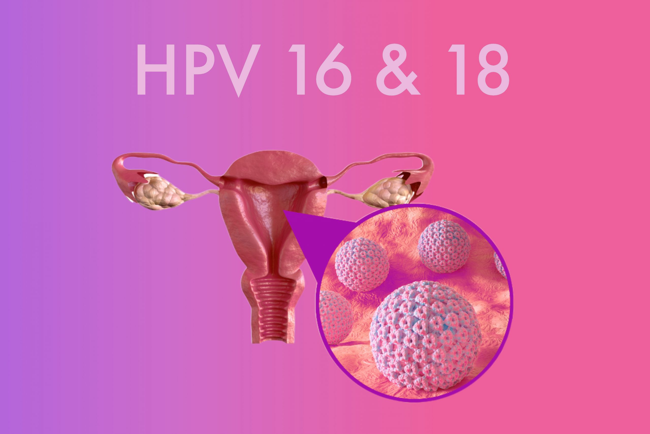تایپ 16 و 18 ویروس HPV زگیل تناسلی