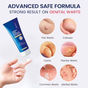 Genital Wart Remover Cream 4